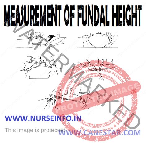MEASUREMENT OF FUNDAL HEIGHT - Nurse Info
