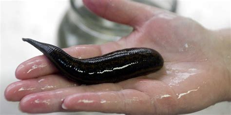 The 10 Most Horrifying Parasites that Infect Humans