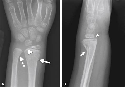 Musculoskeletal - Clinical Tree