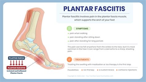 Plantar Fasciitis – Podiatry Infographic | Dr. Salma Aziz, Foot and ...