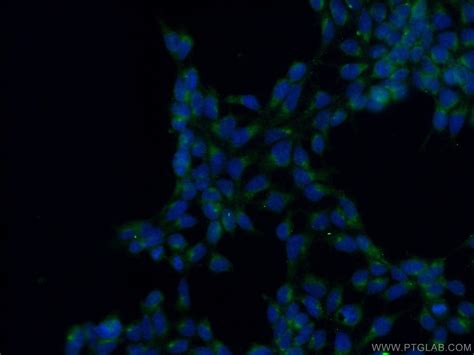 PTCD3 antibody (25158-1-AP) | Proteintech