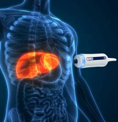 Fibroscan - Fibroscan Liver Test in Ghaziabad & Noida