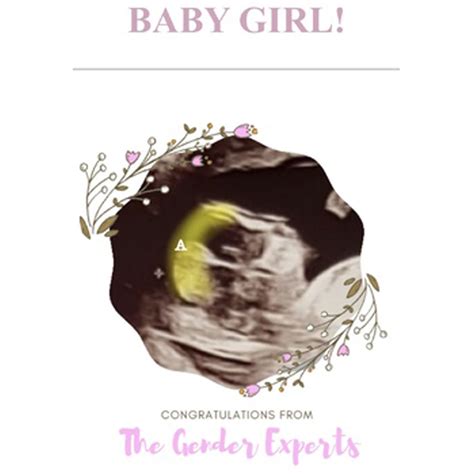 Confirmed Boy and Girl Ultrasound Scans - A Collection of Boy and Girl ...
