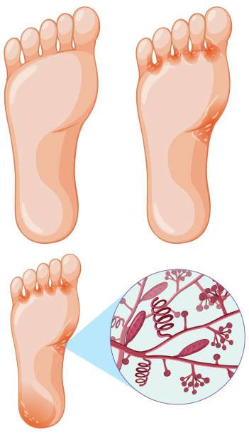 Terbitec Cream Manufacturer and Supplier | Terbitec Cream PCD Pharma ...