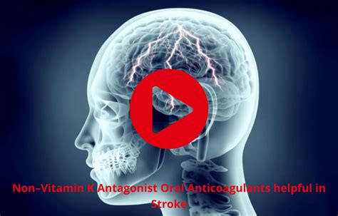 Non–Vitamin K Antagonist Oral Anticoagulants effective in Stroke treatment