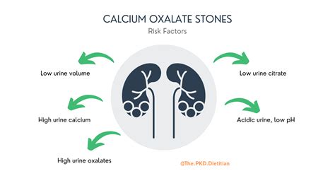 Kidney Stone Risk & Polycystic Kidney Disease, are they connected?