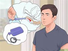come fare un clistere a casa c 243 mo aplicar un 12 pasos con fotos wikihow come fare un clistere a casa c 243 mo aplicar un 12 pasos con fotos wikihow