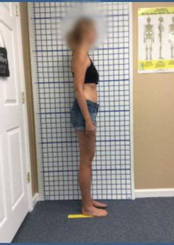 Image result for Structural Integration Exercises