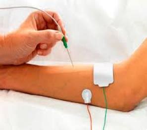 Image result for Neurophysiology Testing