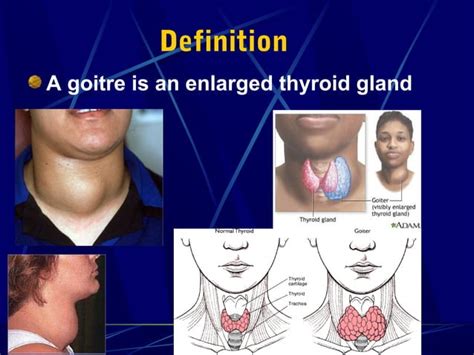 Image result for Thyroid Prediction Using Machine Learning