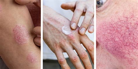 Image result for Different Types of Skin Conditions
