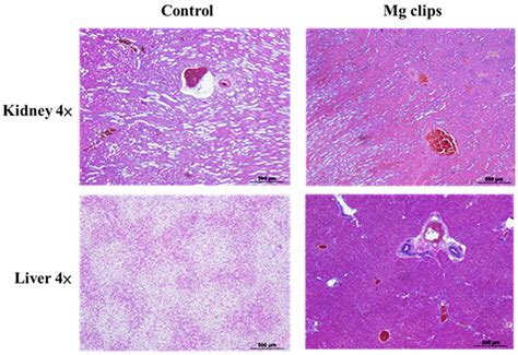 Mg-Zn-Ca Alloys for Hemostasis Clips for Vessel Ligation: In Vitro and ...