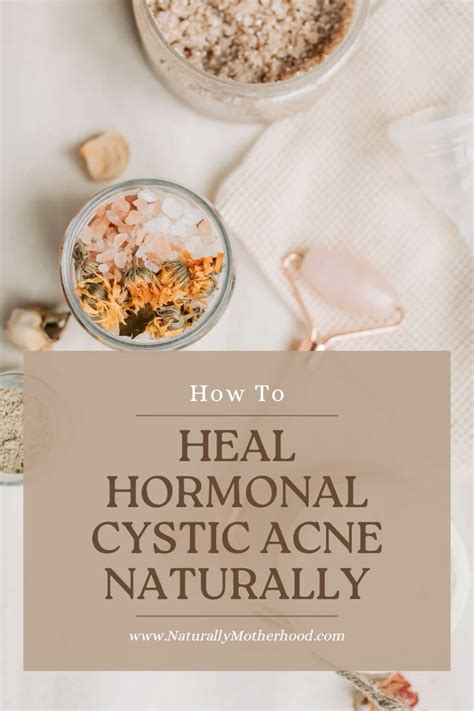 Derms help us get to the root of how to treat hormonal acne – Artofit