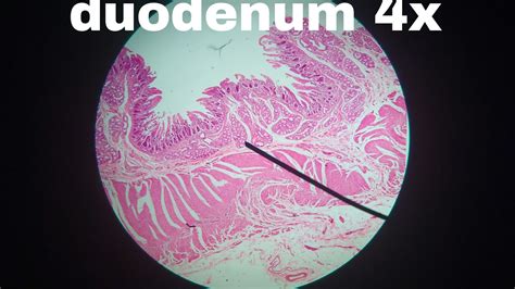 Duodenum Histology