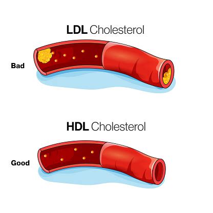 Image result for HDL Components Code
