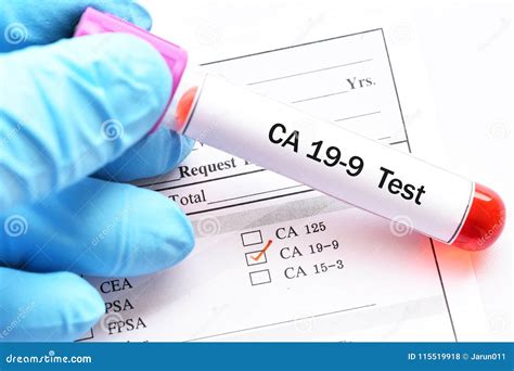 Pancreatic Cancer Markers In Blood Tests - CancerWalls