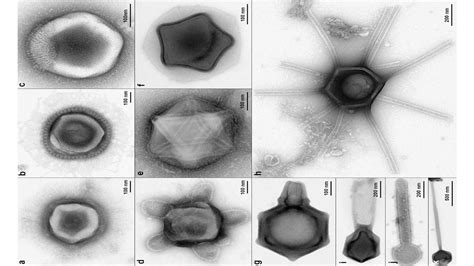 Newly discovered giant viruses look like stars, turtles, and perfume bottles