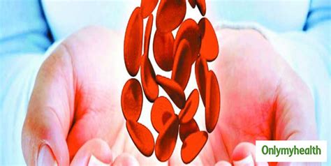 World Hemophilia Day 2022: What Is Hemophilia Symptoms, Causes And ...