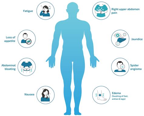 Symptoms Of Masld