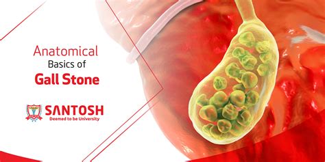 Giant Gallstones and Rare Presentations: Insights and Complications