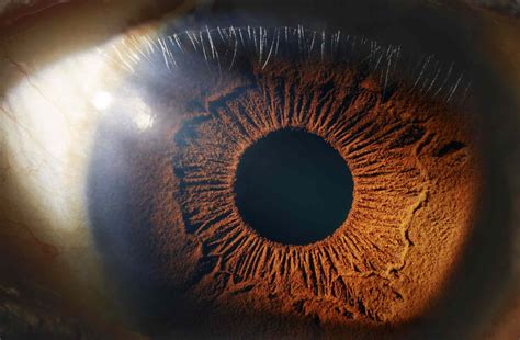 How To Cure Dilated Pupils - Theatrecouple12