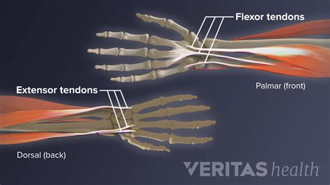 Wrist Tendonitis: An Overview