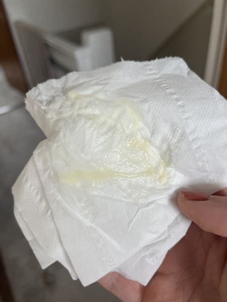 TMI! Pregnancy discharge or mucus plug starting to come away? | Mumsnet