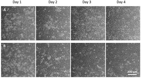 Lung Extracellular Matrix Hydrogels Enhance Preservation of Type II ...