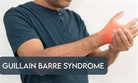 Dengue Infection May Increase Risk of Guillain-Barre Syndrome: NEJM