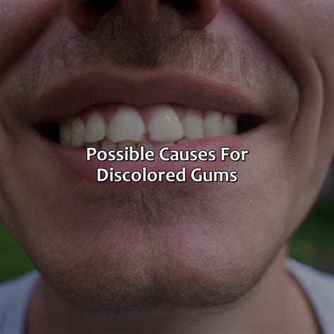 Image result for Gum Color