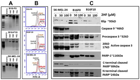 Topical 2′-Hydroxyflavanone for Cutaneous Melanoma