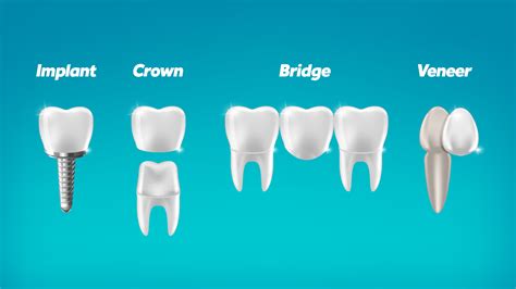 Parts Of Fixed Partial Denture