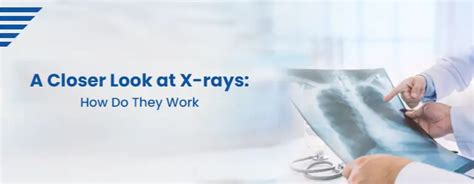 X-ray Technology: How Does It Work?