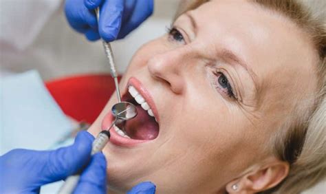 Tooth Extraction 的图像结果