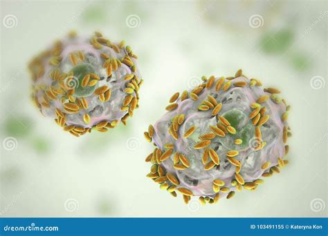 Microscopic Diagnosis of Bacterial Vaginosis. Epithelial Cell, so ...