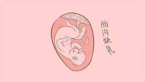 胎儿宫内缺氧会有哪些表现？ - 哔哩哔哩