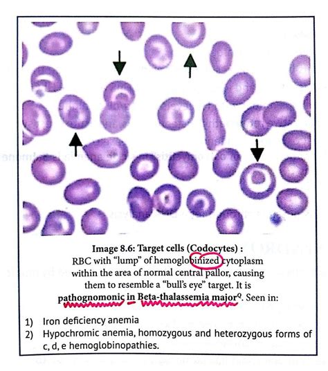 Image result for Target Cells
