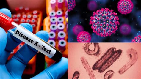 Disease X Outbreak: From Brain-Swelling Flu To Eye-Bleeding Fever ...