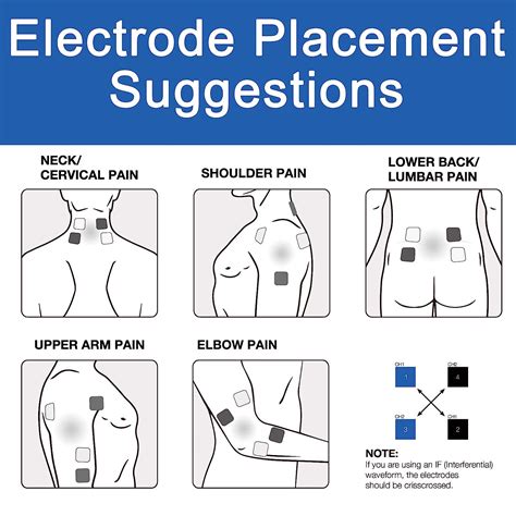 Buy InTENSity 5000 TENS Unit Muscle Stimulator- Professional OTC TENS ...