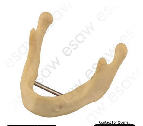 Dental Implant Practice Mandible Model ESAW (DI-107) – 1:1 Life-Size D