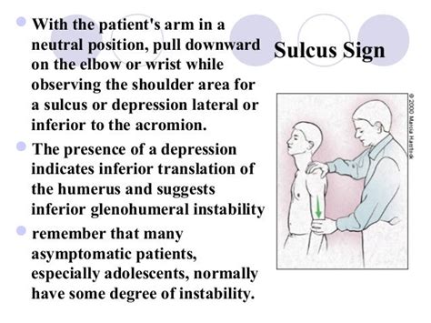 Image result for Sulcus Sign Shoulder