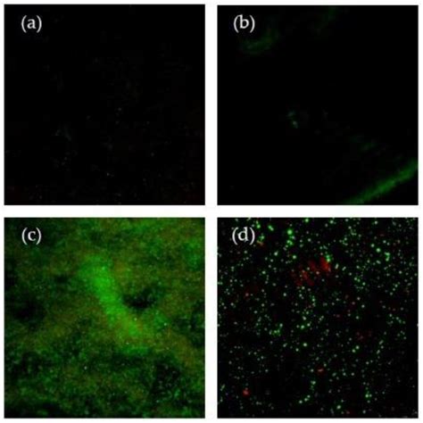 Effect of Surface Roughness of Deciduous and Permanent Tooth Enamel on ...