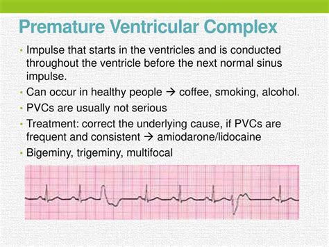 Basic Dysrhythmia Practice Test 的图像结果