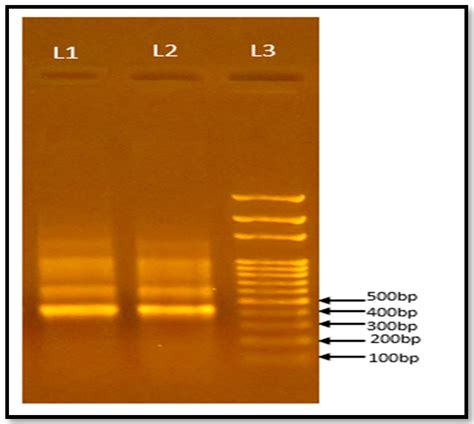 Enhancement of Biogas (Methane) Production from Cow Dung Using a ...