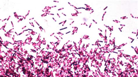 Scientists Treat Hospital Infection With 'Fecal Transplant' | Fox News