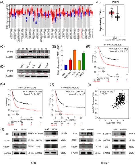 RNA Binding Protein PTBP1 Promotes the Metastasis of Gastric Cancer by ...