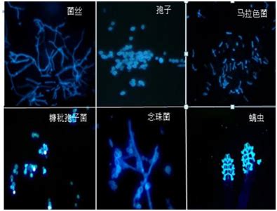 荧光显微镜应用于妇科真菌检测-明美光电