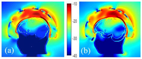 Diagnostics | Special Issue : Electromagnetic Imaging for a Novel ...