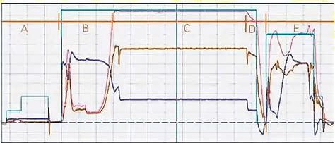 Image result for Pressure Pump Control Loop