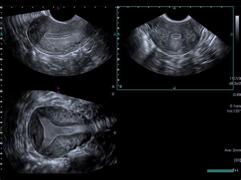Купит УЗД апарат Aplio beyond в Україні